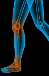 Mycotoxins and Joint Pain