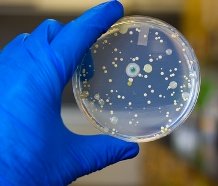 Mold Types Found In Homes Identification Finding Mold Test Kit To Identify Types Growing In Home